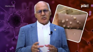 جدري القردة